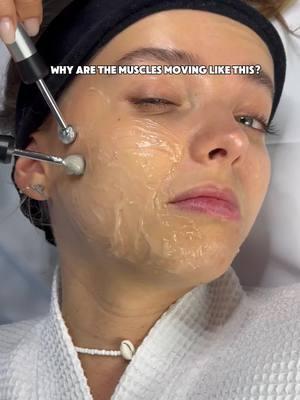 What you’re seeing is microcurrent therapy in action! 💡 Microcurrents mimic the body’s natural signals, reaching deep into muscles to stimulate activity. These low-level electrical currents trigger muscle contractions—safe and effective for toning and re-educating muscles. This process boosts circulation, collagen production, and muscle memory, delivering a lifted, youthful look. Think of it as a gentle workout for your face! Got questions? Drop them in the comments—we’re here to help! #MicrocurrentTherapy #FacialLifting #SkincareTrends2025 #YouthfulGlow #ZemitsTechnology #AestheticDevices