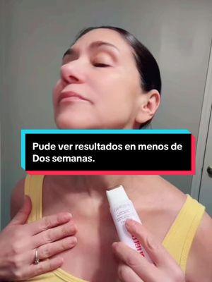 Pude ver el cambio en mi cuello y escote en menos de dos semanas #suero #neckserumroller #belleza #skincare #cuidadodelapiel 