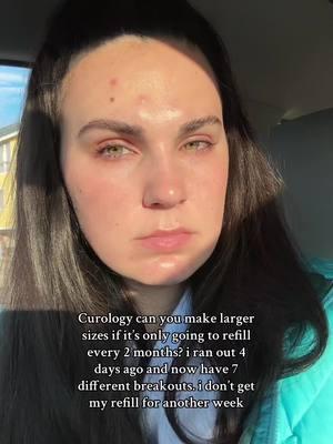 like PLZ #curology #acne 