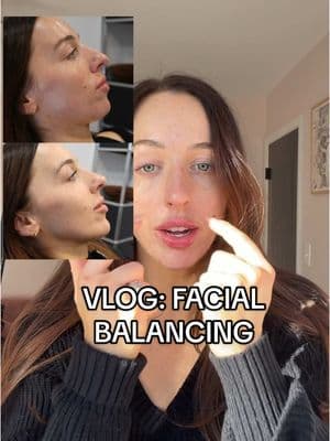 Replying to @ellie facial balancing / filler / chin filler vlog - Skin House, Birmingham MI #chinfiller #lipfiller #chinfillerbeforeandafter #fillerbeforeandafter #facialbalancing 