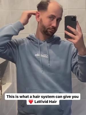 Some people can rock a bald head, while some really look a lot younger with hair ❤️ Link in bio #hair #hairtok #haircut #hairsystem #hairstyle #toupee #hairreplacement #hairunit #menshair #barberlife #salon #menswigs #wigsformen #toupeeformen