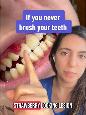 Here’s what it looks like if you never brush your teeth! #dentist #brushyourteeth #teethcavity #oralhygiene #pediatricdentistry 