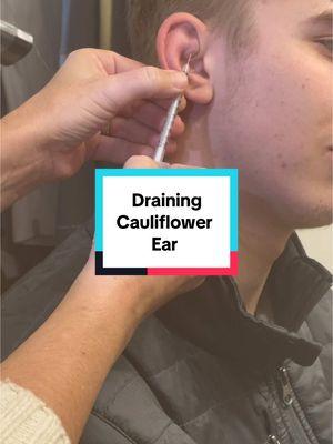 I learned it on YouTube.  #cauliflowerear #cauliflowereardrain #wrestler #drpimplepopper 