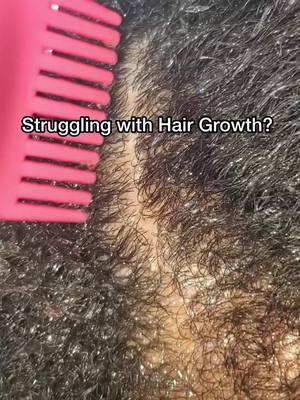 "Healthy hair starts from the root! Bloom Serum is packed with nutrients to promote hair growth. Try it today! 🌱 #naturalhaircareproducts #hairgrowthjourney #healthyhairgrowth 