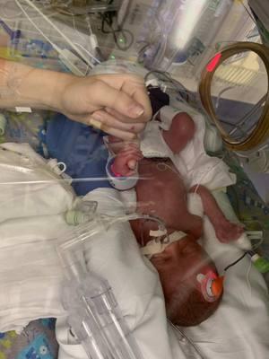 Asking for a survival rate the moment I met him will always break me when I watch these videos back. However, the  ending couldn’t bring me more peace or happiness. ❤️  #nicu #nicumom #nicubaby #nicustrong #preemie #premature #prematurebaby #spasticcerebralpalsy #caraccident #placentaabruption #emotional #lifesupport #hospital #birth #trauma #traumaticbirth #prematurebirth 