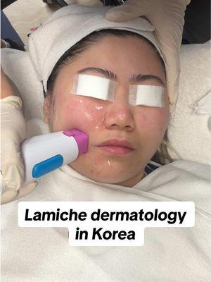 Thank you so much @Lamiche Dermatology 🥰  . I got a new jawline in Korea 🫣😱 kinda obsessed with my results..  . Clinic: 클럽미즈라미체의원 . #seoulclinic#seouldermatology#koreaskincare#koreadermatology#kskincare#skindermatology#korea#kbeauty#kskincare#southkorea#lamiche#lamicheclinic#lamichedermatology