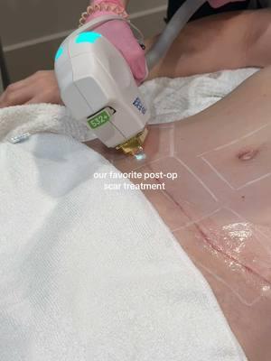 Post-op recovery just got a glow-up! 🌟  Our BBL Laser + Clear Silk treatment is designed to help reduce the appearance of post-operative scars, promoting smoother, more even-toned skin after surgery. With consistent care, we can work together to enhance healing and bring out your natural radiance.  Esthetician: Ali Rasor  Surgeon: @Dr. Chiddy ⭐️ Plastic Surgeon  #PostOpCare #ScarHealing #BBLGlow #MommyMakeover #AestheticRecovery