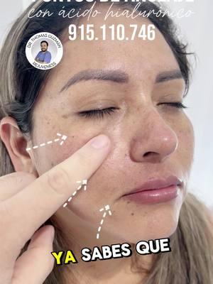 No te dejes engañar, rejuvenecer en 30 minutos es posible con nuestra exclusiva técnica de puntos de anclaje con ácido hialurónico. Reserva tu cita ahora mismo. #cambiodelook #bellezafemenina #hialuronico #botoxfacial #cambioradical #BeautyTok #lima #depilación #hazmeviraltiktok #rejuvenecimientofacial #peru #filler #peruanos #fullface #rejuveness #primeravez #botoxperu