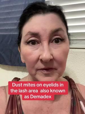 Dust mites on my eyelids. Demodex #helpmeplease #help #helpme #suggestions #suggestion #demodexmites #demodexmite #demodex #mites #dustmites #viralvideo #videos #blowthisup #fyp #foryoupage #youtube #foryou #foryoupage #foryourpage #fypage 