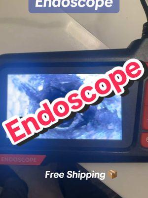 Look in all the tight spots with this endoscope #endoscopy #endoscope #tiktokmademebuyit #trending 