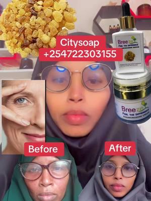 #creatorsearchinsights #skincare #somaliticktok #somalia #muqdishotiktok #muqdisho #hargaysa #jigjiga #kenyantiktok #nairobitiktokers #nairobi #isliinairobi #islii #mombasatiktokers #garissatiktoker #wajirtiktokers #tik_tok #newyear #2025 #antiaging #salon 