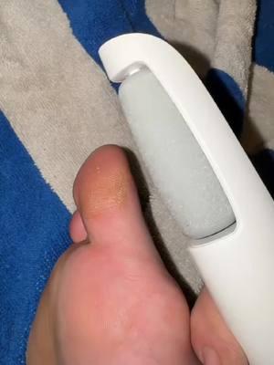 This is actually insane. #callousremoval #beautyhacks #beautyproducts #callousremover #callousedfeet #deadskin #crackedskin #dryskin #skincare #skincarehack #beautyhacksforwomen #pedicure #sosatisfying