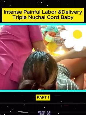 Intense Painful Labor & Delivery Triple Nuchal Cord Baby - Part 1 #laboranddelivery #childbirth #birth #newbornbaby #usa🇺🇸 #fy 