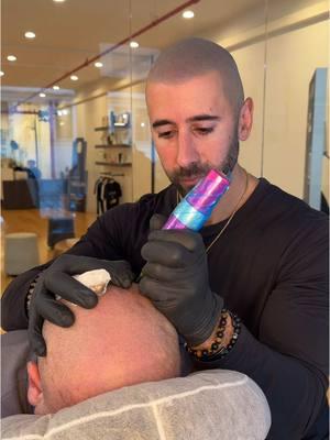 back to the scalp grind! Lmk if you’re dealing with hair loss 👍⚫️🖊️ #scalpmicroigmentation #hairtattoo #scalptattoo #fyp #scalpmicropigmentation #hairloss #scalpmicrousa #micropigmentacion 