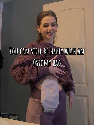 Happiness isn’t about being ‘perfect’—it’s about embracing who you are. My ostomy bag doesn’t hold me back; it’s proof of my strength 💪✨  #OstomyLife #ThrivingWithScars #OstomyLife #OstomyBag #ChronicIllnessWarrior #InvisibleDisabilities #SelfLoveJourney #BodyPositivity #ThrivingNotJustSurviving #MedicalJourney #StrengthInScars #LifeAfterSurgery #ResilientAndProud #OstomyPride #ChronicIllnessAwareness #LivingWithAnOstomy #IBDWarrior #OstomyStrong #UnapologeticallyMe #HealthAdvocate #SurvivorStory #BagLife #InvisibleIllness #MedicalMiracle #StrongerEveryDay #AdaptAndThrive #LifeWithPurpose #ViralJourney #ForYou #FYP #OstomyAwareness #RelatableContent #ChronicIllnessSupport #UniqueAndProud #Storytime #BodyConfidence #WatchThis #InspoDaily #FollowForMore #EmpowermentJourney #BoostYourFeed #MakingWaves