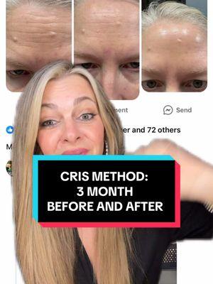 #greenscreen another CRIS METHOD before and after from November to today. Kristy’s journey of consistency, product order and great products impacted her texture and forehead lines so much #skintransformation #beforeandafterskincare #skincareresults #crismethod #thecrismethod #skincareroutine #skincarethatworks #antiaging #foreheadlines 