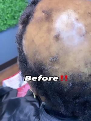 Comment BELOW👇🏽 ✨Share this video with SOMEONE who NEEDS to see this!!✨ 📍Dallas, Texas 🚨 WE HAVE ALL YOU NEED!!! 🚨 Schedule with us today‼️ 📲 LINK IN BIO ⬆️ Appointments available‼️ Accepting new clients 😍 🌟 Follow @Thebraidercom for more stunning styles! 🌟 📅 Customer Service Hours: Tuesday - Saturday | 9am-7pm 📚 For classes, follow @thebraiderhairacademy 💇‍♀️ Have hair questions? Fill out our FREE complimentary consultation form online NOW! 👉🏽 http://www.thebraider.com/consultation.html #thebraidercom #customwigdallas #dallasbraids #michiganbraider #dfwhair #closuresewin #dallashair #alopecia #dfwbraider #dallasbraiders #boxbraids #alopeciaareata #alopeciahairstyles #alopeciabraider #alopeciadallastx #californiabraider #lasvegasbraider #houstonbraider #texasbraider ##dallasbraider #braider #naturalhairstylist #protectivestyles #dallashairstylist #braidstylist #hairtransformation #braidingclasses #hairgoals #braidtraining