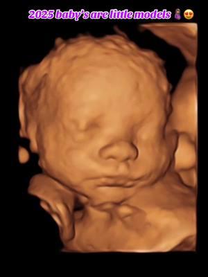 🥰☺️😍 . . . . . . #sneakababypeek #ultrasound #lasvegas #henderson #vegasmom #genderchecks #heartbeatchecks #3Dultrasound #4Dultrasound #HDLive #mom #dad #baby #pregnancy #pregnant #Fyp #8k #digitalframes #heartbeatanimals #gendercannons #genderextinguisher #27weeks #34weeks #tips #baby #ultrasound #3d #vegas #sneakababypeek #mom #momlife  