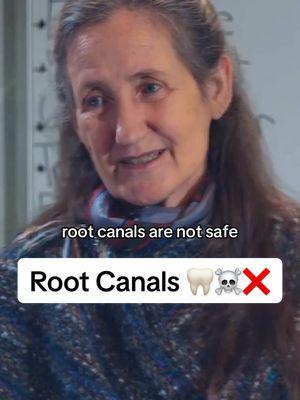 Root canals! #barbaraoneill #rootcanals #teeth #teethtok #teethcare #dentist #creatorsearchinsights 