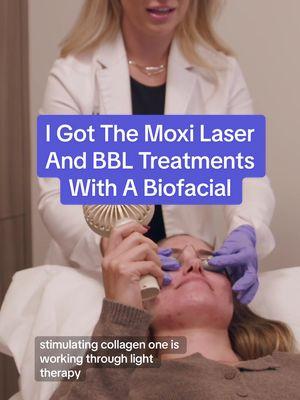 Watch until the end to see the results!  @Dr. Michelle Lee | PERK at Perk Plastic Surgery in Beverly Hills gives our talent Triana Garcia the Moxi Laser and BBL (Broadband Light) treatments for the first time. #moxilaser #bbl #beauty #skincare #dr90210 