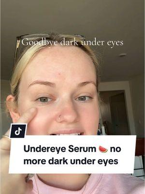 Dark under eyes where? These serum drops from @Nature Spell Inc have really worked💗  🍉 #undereyeserum #skincare #darkcirclesundereyes #undereyecircles #darkundereye #skincareproductsmusthave #tiktokshopcreatorpicks #ttslevelup #giftguide #watermelonseeds #undereyeserums #momhack #LifeHack #beautycreator #beautycontent #howtogetridofdarkcirclesunderyoureyes #creatorsearchinsights 