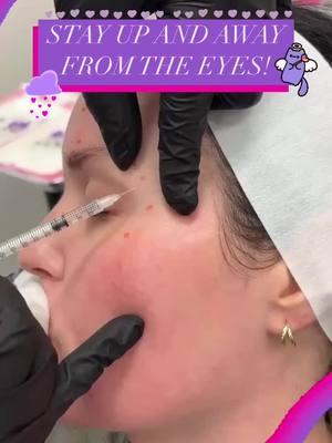 Crows feet are no match for neurotoxin! 🐦‍⬛❌ Learn how to do this and much more at facialesthetics.org   Learn it. Live it. Give it!  Get AAFE Certification trained today! ° °  ° #AAFE #aafecertified #esthetics #facialesthetics #botox #filler #education 