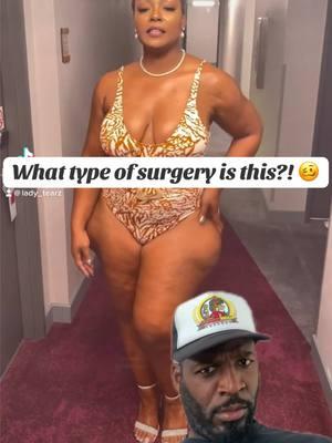 This surgery was literally CRAZY WORK! 🥴😂 Since they taking TikTok away Sunday, y’all make sure y’all follow me on Instagram so we can stay connected! My @ is youknowmaaaacus_  Come see me live! -1/19/25 Hyena’s Dallas, TX  -2/28/25 Mic Drop Phoenix, AZ Ticket link in my linktree/bio #botched #surgery #botchedsurgery #tiktokban #reaction #commentary #hips #hipsurgery #greenscreenvideo 