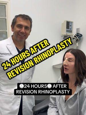 ✅ No bruising ✅ No Swelling ✅ No packing Our lovely 43 year young patient flew ✈️ in from North Carolina to New York City 🏙️ for her dream nose She had her primary rhinoplasty about 20 years ago (done elsewhere). She disliked the length and the shape of the nose overall and wants a more elegant and contoured nose.  She is now 1 DAY post-op and she has minimal swelling, no bruising & no packing! Shes going to the Hamptons this weekend and then back to North Carolina ✈️ We will be following up with her after she gets her cast off and will share her results, so stay tuned! 🤗 ☎️ 212-288-3000 💌 DM us 📲 WhatsApp: 201-875-8482 Locations: 📍65 East 66th Street, New York, NY 10065 📍81 North Maple Avenue, Ridgewood, NJ 07450 #bestplasticsurgeon #topplasticsurgeon #newyorkplasticsurgeon #rhinoplastyny #rhinoplastynj #cutenose #bestrhinoplasty #rhinoplastyrecovery #newjersey #rhinoplastyspecialist  Disclaimer: I do not own or claim to own the audio in this video. All rights and permissions are granted to the owner of this sound.