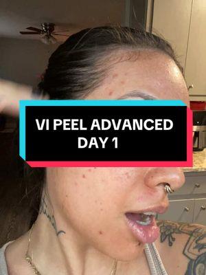 If any of my IG simps see this, it’s exactly what it sounds like babe, send me the money #chemicalpeel #cosmetic #skintok #medspa #skintreatment #vipeel #atx #austintexas 