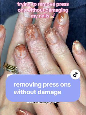 Replying to @RUNFORESTRUN what are your best no damage press on removal tips that don’t take as long as this? 😂 #presson #pressonnails #pressonremoval #nails 