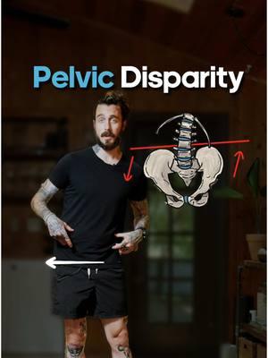 Feeling off-balance? It might be pelvic disparity! 🧘‍♂️ Learn how to align your hips with these simple exercises for better movement. #HipHealth #pelvicalignment 