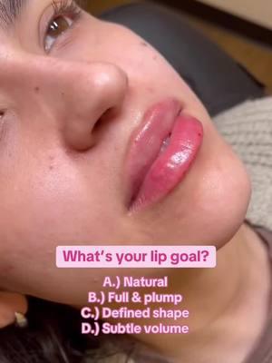 What’s your lip goal? 👄 #lipgoals #lipfiller #lipinjection #lipinjections #juicylips #plumplips #naturallips #medspa @Taylor💉 