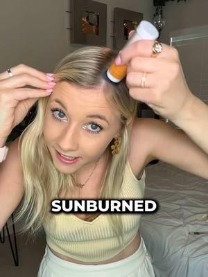 SUNBURNS HAPPEN YEAR ROUND! #sunblock #powderedsunblock #preventivecare #sunburnt 