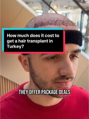 Replying to @Blastland How much does it cost to get a hair transplant in Turkey? #hair #hairloss #hairgrowth #hairprogress #haircare #hairline #recededhairline #regrowth #bald #balding #thinning #thinhair #thick #full #products #medication #treatment #finasteride #minoxidil #scalpmassager #rosemaryoil #dermaroller #xyon #xyonpartner #growplex #aimike #rogaine #keeps #hims #propecia #kirkland #topical #foam #liquid #oral #pill #journey #transformation #daily #series #day180 #tutorial #stepbystep #routine #regimen #results #proof #beforeandafter #slowlybutsurely #trusttheprocess #followalong #explanation #education #explained #DHT #hairfollicles #baldspot #howto #consistency #everyday #nevergiveup #positivity #motivation #hairtok #fyp #viral #xybca #chris #zeph #ibby #freddy #turkey #vitamins #biotin #hairtransplant #grafts #donorarea #complex10 #suppliment #prescription #hairfibers #hairfiller #fibers #veraclinic #mane #maneexlirblend #maneoils #maneoilblend #price #turkey #istanbul #medicatedlotion #lightlytap 