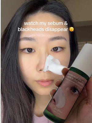 The easiest way to remove gunk and leave my nose squeaky clean 👃🏻✨@dr.althea_official  #dralthea #draltheaglobal #kbeauty #koreanskincare #blackhead #sebumcleanser 