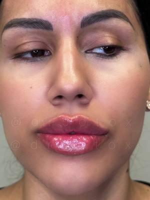 Cómo se ven los labios rusos #russianlips #labiosrusos 