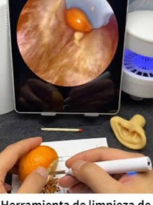 La cuchara de excavación de orejas con cámara puede ver claramente todos los rincones de la oreja, puede experimentar la diversión de cavar orejas en casa, tanto para adultos como para niños.#TikTokShop #tiktok  #earwaxremoval #earwax #satisfyingvideo #oddlysatisfying #gross #pimplepopper #family #christmas #TikTokShop #fyp#earpick  #TikTokShopLoveAtFirstFind  #spotlightfinds 