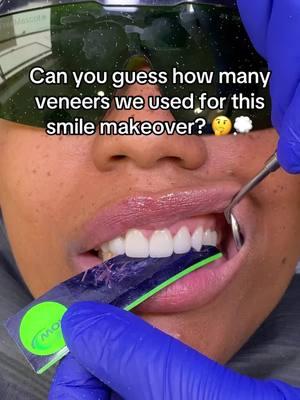 Can you guess correctly? 🤔💭👇 #limitedveneers #bitework #veneers #veneersteeth #porcelainveneers #naturalsmile #dentalveneers #closinggapsbetweenteeth 