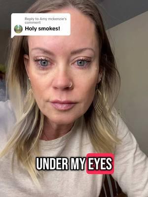 Replying to @Amy mckenzie Literally takes the dark circles and bags away! #undereyebags #undereye #undereyecream #undereyeserum #undereyecircles #darkcirlces #undereyebagsbegone #undereyecorrector #undereyeconcealer 