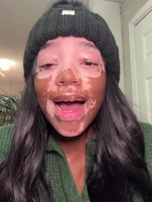 #fyp #vitiligo #trueseamoss #wellness 