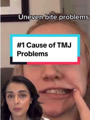 🚨 The #1 cause for TMJ problems is...  ...AN UNEVEN BITE. 🤯 As I have treated more & more TMJ/TMD patients, I've realized that an uneven bite is more commonly the cause of my patients' TMJ pain & dysfunction...even more so than hypermobility, hormones, sleep apnea, clenching & grinding, etc. Have you had your bite evaluated?! 🎥: @ tumbleweedfeed via TT . . . . #tmjpain #jawpaintreatment #tmjd #unevenbite #tmjrelief #jawpainrelief  #teethgoals #TMJDisorder #jawpain #tmjrelief #tmjtreatment #happyteethhappylife #bruxism #tmjd #dentalgram #dentistsofinstagram 