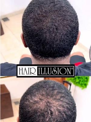 Bald spots are now optional 👀🔥 Let’s get real 🤝🏽 losing your hair can feel like you’re fading into the background. But what if you could step back into the light? 👀 What if the thing that once made you feel small became the reason you stand tall? 🧐  This reel is proof that Hair Illusion isn’t just a product, it’s a game-changer. 💯 🔥 Watch the shift: A bald spot that tells a story transforms into something untouchable, undeniable.  That’s the power of Hair Illusion’s Real Hair Fibers 🏆🪄 Made from real human hair, these fibers blend seamlessly, turning doubt into confidence & insecurity into a flex. 🔥 🎵 Why Hair Illusion hits different: ⚡ Instant glow-up because who has time to wait? 🤣 ⚡ Water and sweat-resistant so your shine doesn’t fade when life gets real. 💧 ⚡ Foolproof and effortless because some things are meant to feel easy. ✅ ⚡ Natural as the truth no one’s gonna know unless you want them to. 🤫 This isn’t just about filling in the gaps it’s about stepping into who you’re meant to be. The main character. 🌟  The one they can’t stop looking at. 👀  Don’t just watch the magic, become it. 💥 💌 Slide into our DMs or hit the link in bio. Your moment starts here. 💎 Tag someone who needs to feel untouchable again. #HairIllusion #HairTransformation #BaldSpotFix #ConfidenceBooster #ThinningHairSolution #HairFibers #InstantGlowUp #RealHairFibers #AlopeciaAwareness #HairLossHelp #RealResults #NaturalHairCare #WaterResistantHair #MenHairCare #WomenHairCare #ThinningEdges #ScalpCoverage #InstantFix #HairCareHacks #HairCareTips #BoldAndConfident #HairIllusionMagic #HairJourney #ThinningHairSolutions #AlopeciaSupport #NoMoreBaldSpots #TransformationTuesday #BeforeAndAfterHair #GlowUpJourney #confidenceonlock 