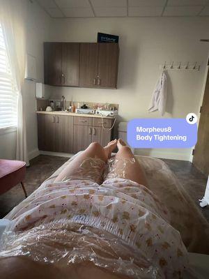 Starting my head to toe Morpheus8 journey 🤣🫶🏼💖 #bodytreatment #medspaservices #medspa #weightloss #weightlossjouney #toneandtighten #looseskin #stretchmarks #bodyconfidence #bodycontouring #summerbod #summerbodloading #skincare #skincareservices #morpheus8 #morpheus #morpheus8body #bod #skin #dalton #daltonga #atlanta #chattanooga #northgeorgia #calhounga @AIBMedicalSpa 