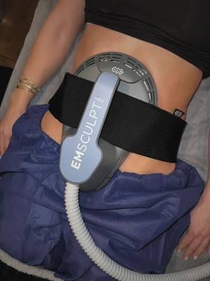 Have you ever wanted to burn fat without a workout? Or get refined abs without a gym? Emsculpt can help you do just that. EMSCULPT NEO® is a revolutionary, first of its kind treatment that builds muscle and reduces fat at the same time through the combination of targeted electromagnetic and radiofrequency energy. It builds, tones, and defines the muscles of the body, giving a tighter and more contoured look, while also reducing fat in the treatment area. A single EMSCULPT NEO® treatment to the abdomen is the equivalent of 20,000 sit ups or crunches. Clinical studies have shown up to 30% reduction in fat and 25% increase in muscle tone/definition after a series of 4 EMSCULPT NEO® sessions. Ready to transform? Book your consultation today and take advantage of this amazing offer! ………………………………………….. 📱Feel free to contact us for more info or to schedule your treatment! ……………………………………………⠀⠀ ☎️ Phone: 818-789-5500 🌍Website: www.zcosmetichealth.com 📩 Appointments: info@zcosmetichealth.com 📍Location: Sherman Oaks, CA …………………………………………… 🧴Shop Zadeh MD Skin: www.shopzadehmdskin.com …………………………………………… For more before and after photos, information on my techniques, and verified reviews from patients checkout 👤Facebook/IG: @zcosmetichealth ⏰ TikTok: @zcosmetichealth ▶️ YouTube: @zcosmetichealth 📬 info@zcosmetichealth.com #emsculptneo #workoutinspo #absworkout #losangelesgym #lagym #gymgoals #tonedabs #pilatesfit #6pack #mensworkoutabs #crunchesworkout #abschallenge #beachbodyondemand 