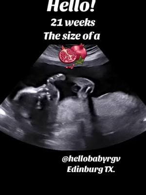 A pomegranate! ☺️This is your baby at 21 weeks gestation! 🤗 2D ultrasound @hellobabyrgv Edinburg TX. 📲956-777-4916 #baby #mother #mama #ecografia #ultrasonido #embarazadastiktok #rgv956 #fypシ゚viral #mcallentx #edinburgtx #trendingvideo #trending #ValentinesDay 