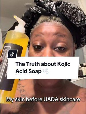 #stitch with @LiiNatural the truth about Kojic Acid soap for dark spots! #darkspottreatment #darkspotskincare #skincarefordarkspots #evenskintone #brighteningskincare #kojicacidsoap 