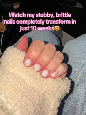 💅🏼i will NEVER go back to the nail salon again!! #nailgrowth #nailgrowthoil #nailgrowthjourney #nailgrowthserum #howtogetlongnails #strongnails #howtogetstrongnails #viralnailoil #nailoil #gelxnails #gelxnailsathome #nailsathome #thisisyoursign #foryoupage #beauty #beautytips #nailtips #brittlenails #TikTokShop 