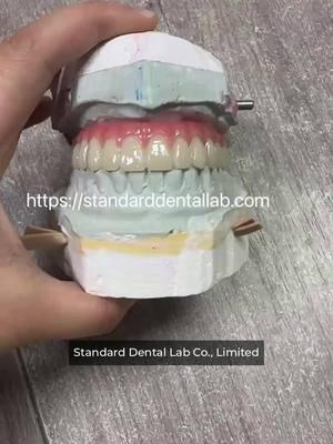 top manufacture in china dental implant crown zirconia crown most advanced dental lab #topmanufacture #zirconiacrown #mostadvanceddentallab #chinaimplant #dentalimplant