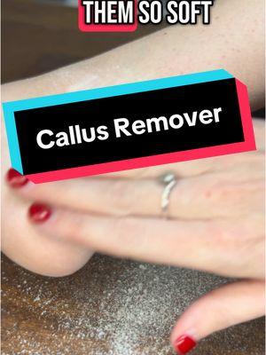 If you have bad calluses on your feet, then you need this little callus remover. It’s amazing! #pritechcallusremover #fypシ #fyp #feet #TikTokShop #b#beautys#skin