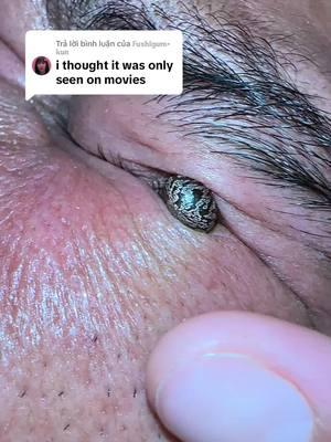 Trả lời @𝔽𝕦𝕤𝕙𝕚𝕘𝕦𝕣𝕠-𝕜𝕦𝕟 Omg #creatorsearchinsights #ohmygod #tickshot #tickseason #ticks 